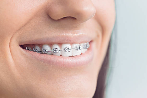 Laser Dentistry in Villisca, IA